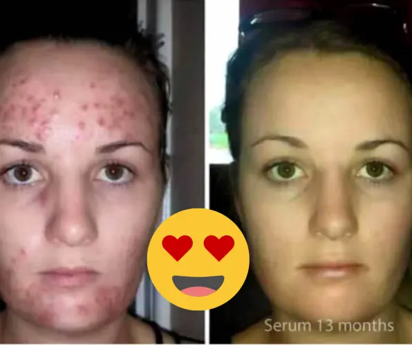 Luminesce® Sérum de Régénération Cellulaire