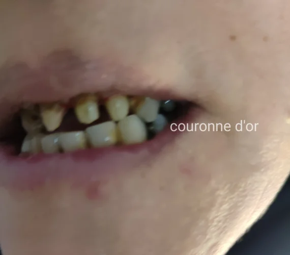 Centre dentaire spécialisé Odontologie conservatrice