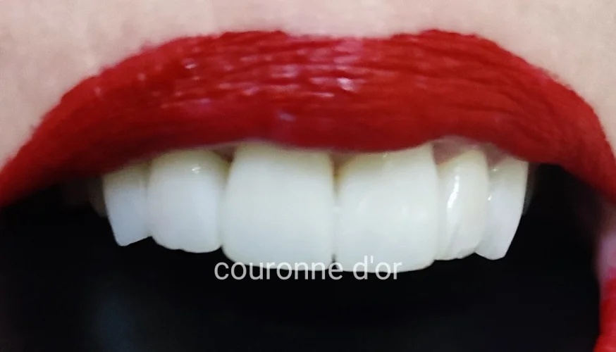 Centre dentaire spécialisé Odontologie conservatrice