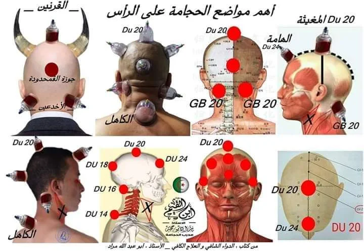 حجامة منزلية