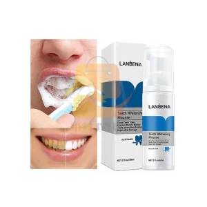 اعتني بأسنانك