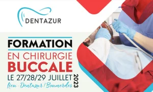 FORMATION EN CHIRURGIE BUCCALE avec TP sur patients